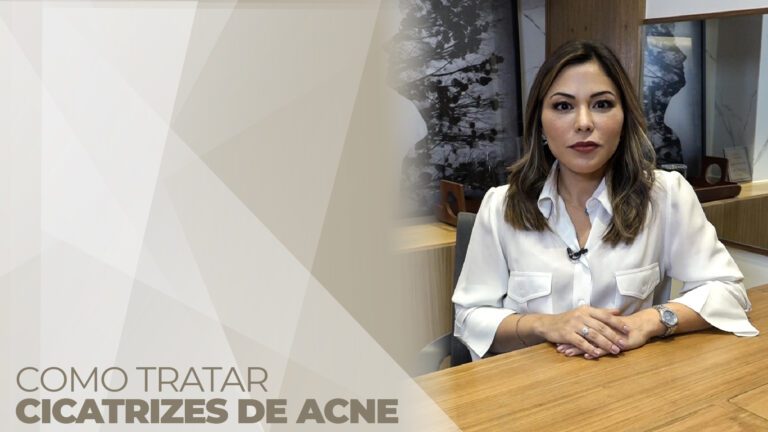 Cicatrizes de acne: como tratar?