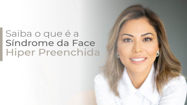 Síndrome da face hiper preenchida: o que é?