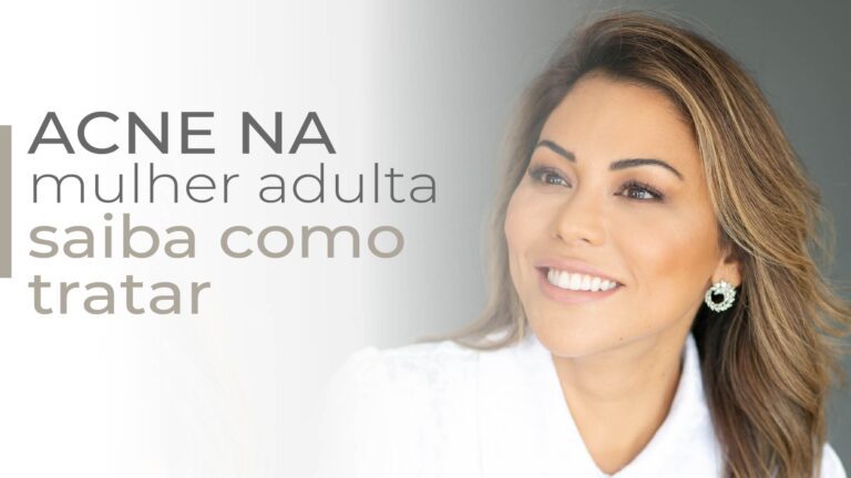 Acne da mulher adulta: como tratar?